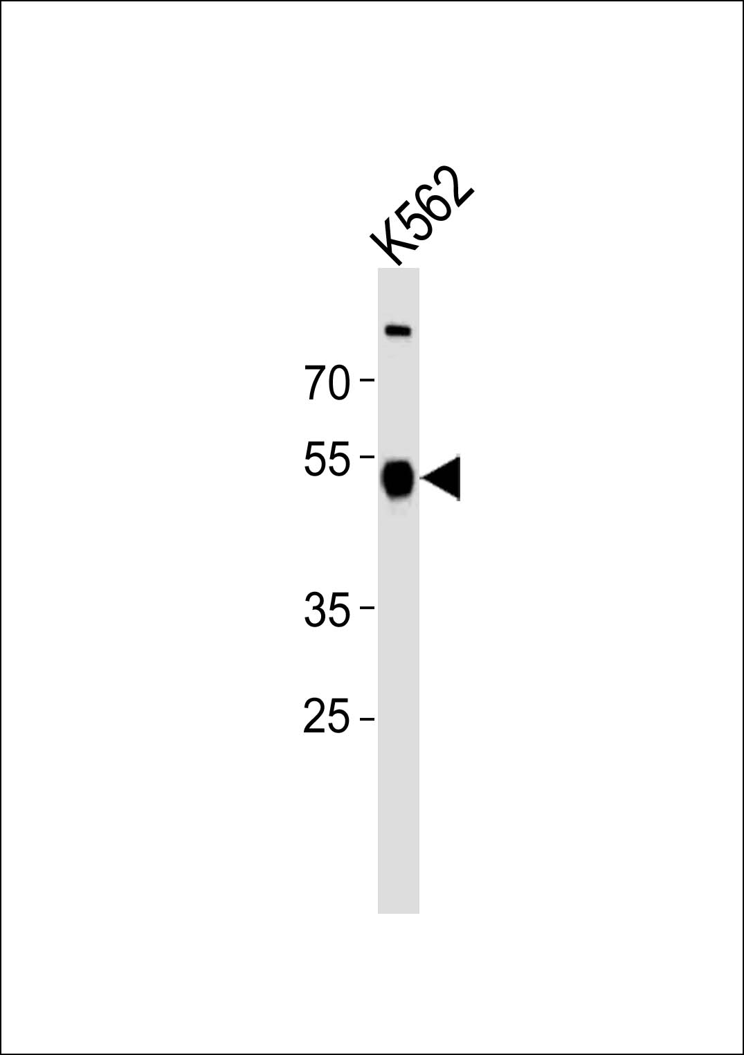 ZNF500 Antibody