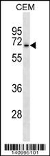 ACCN3 Antibody