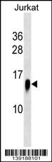 ATP6V1F Antibody