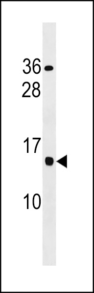 YQ013 Antibody