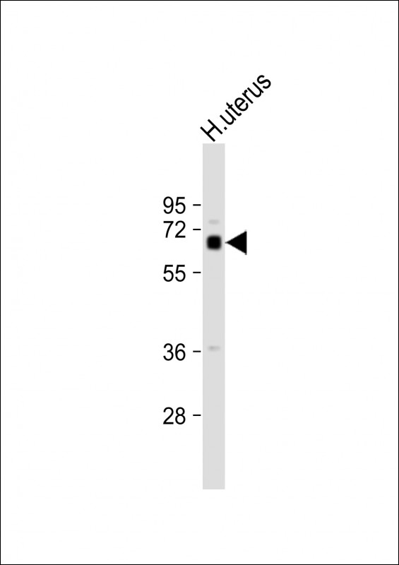 ZFP64 Antibody