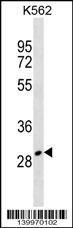 ZNF365 Antibody