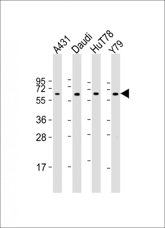 YY1 Antibody