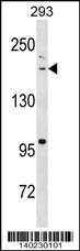 BAZ1B Antibody