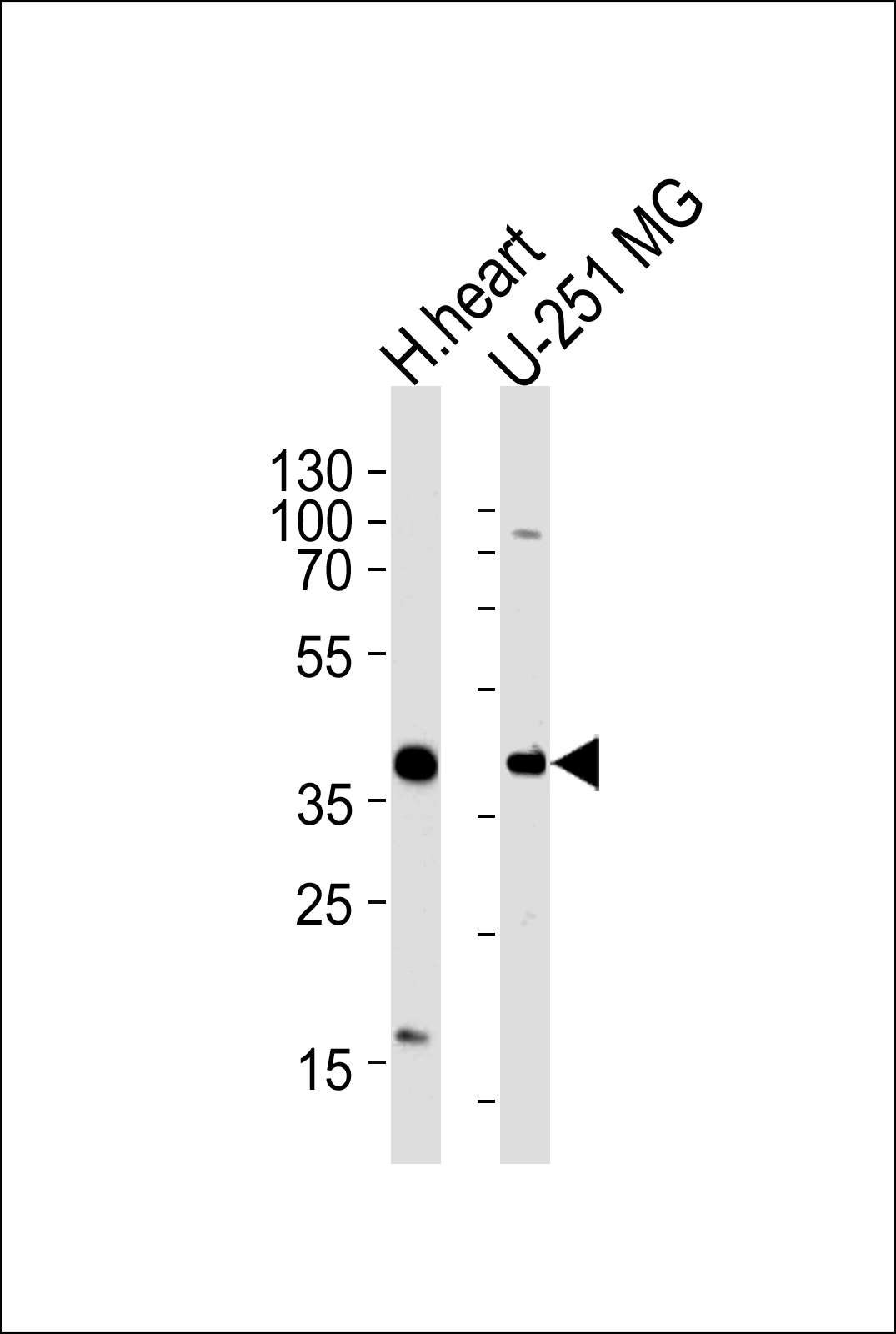 AKTIP Antibody