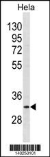 BRMS1 Antibody