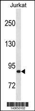 ZNF337 Antibody