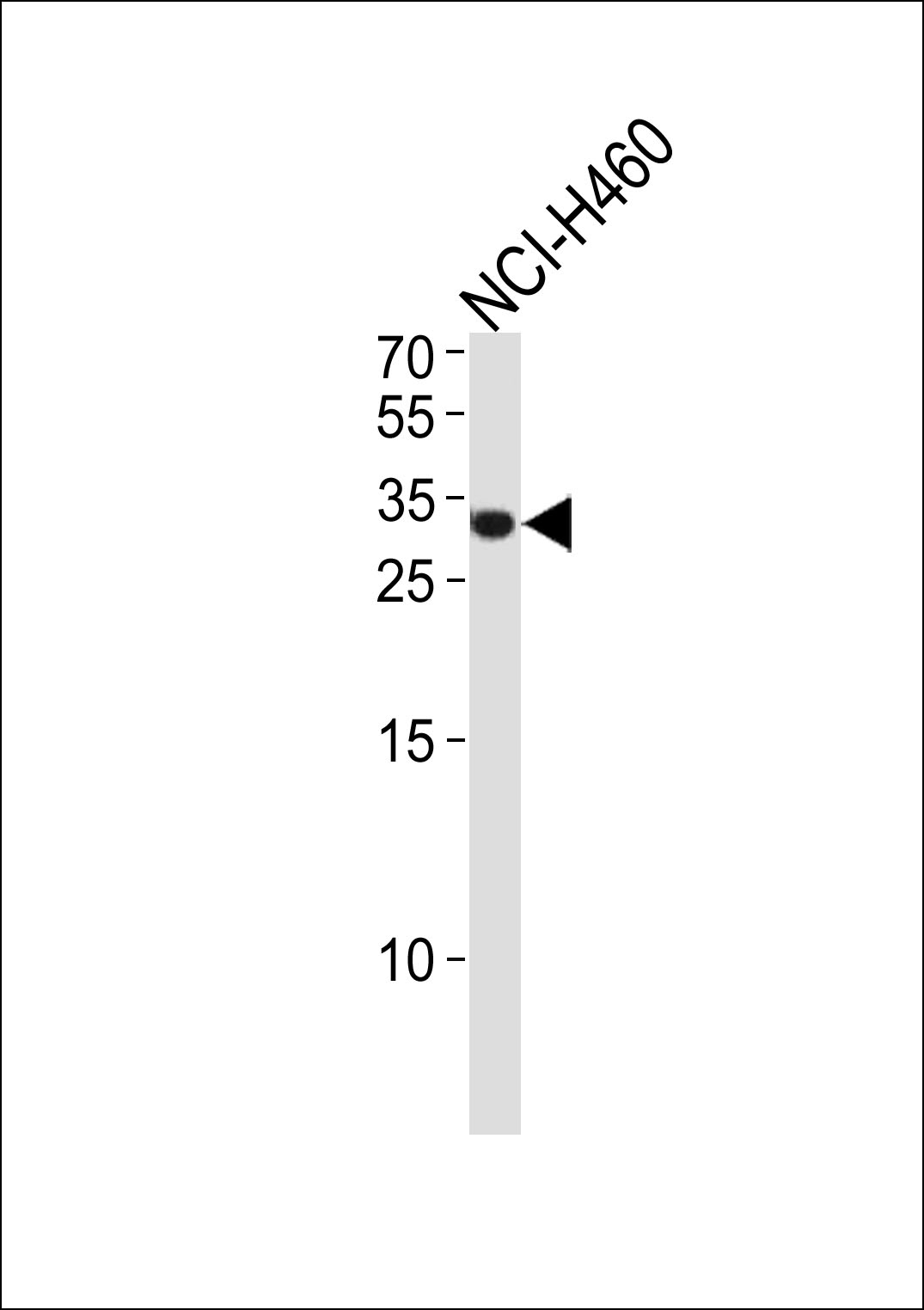 ASCL1 Antibody