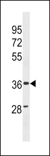 ZC3HAV1L Antibody