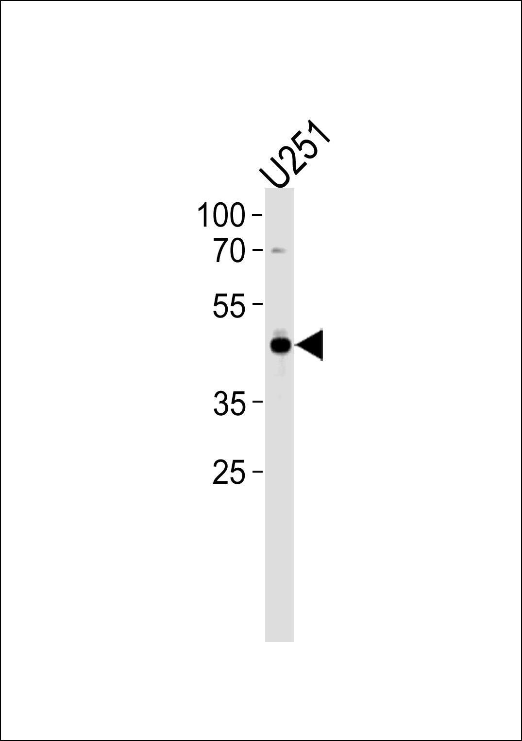 AP2 alpha Antibody