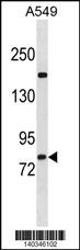 ZNF782 Antibody