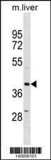 ZFP36L1 Antibody