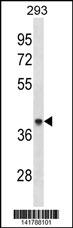 ACAA1 Antibody