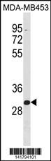 ZNF367 Antibody