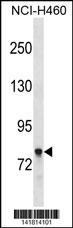 AMPH Antibody