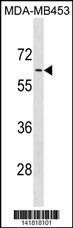 ADRA1B Antibody