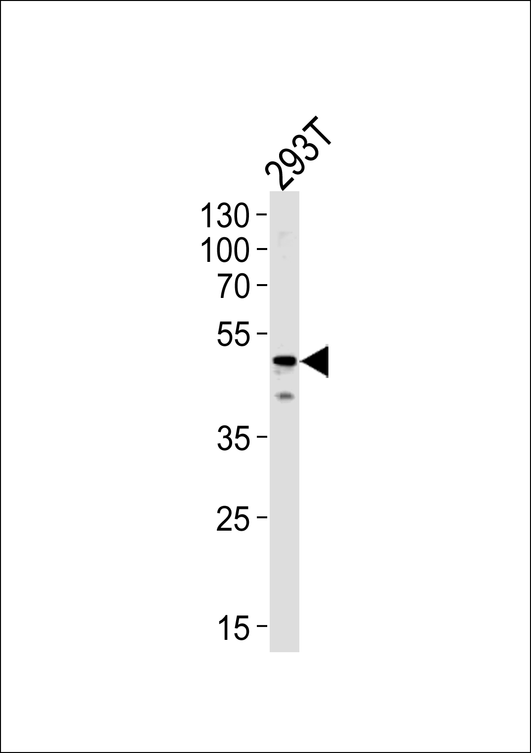 YBX1 Antibody