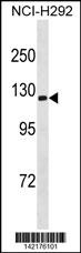 ATP1A3 Antibody