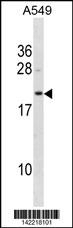 BLVRB Antibody