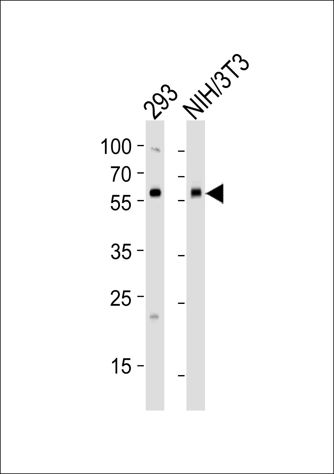 BMPR1A Antibody