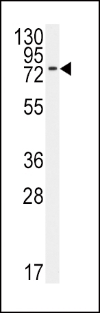 BMPR1A Antibody