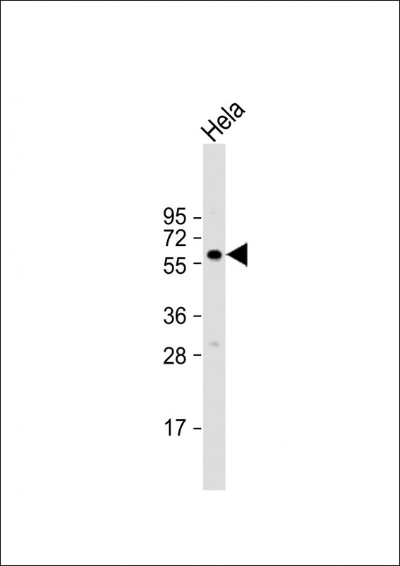 BMPR1A Antibody