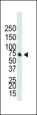 BMPR1B Antibody