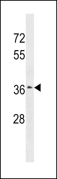 ZSCAN23 Antibody