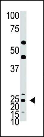 ASCL1 Antibody