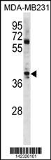 ATOH1 Antibody
