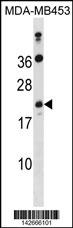 ATP5S Antibody