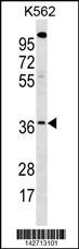 WBSCR22 Antibody