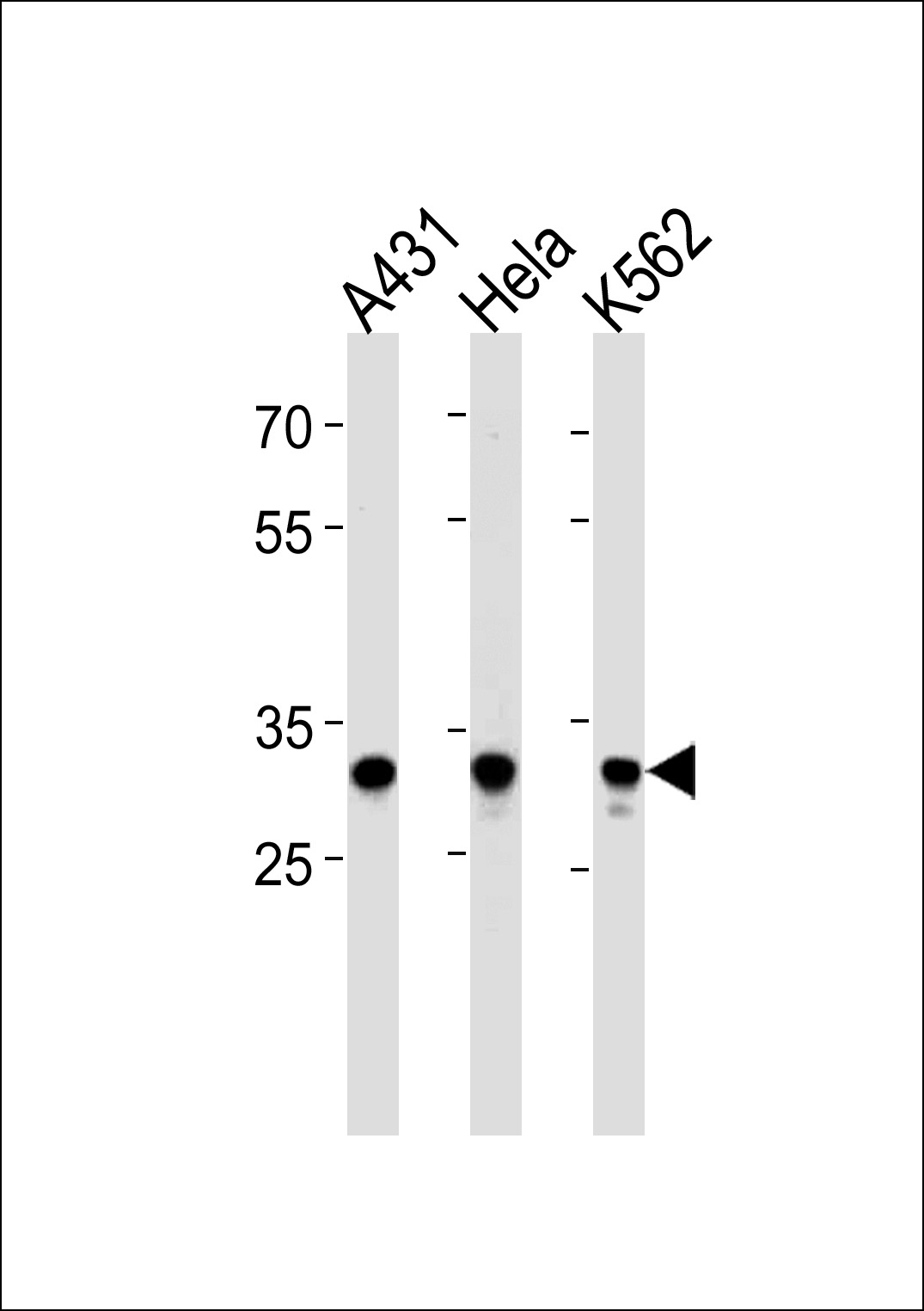 APBB3 Antibody
