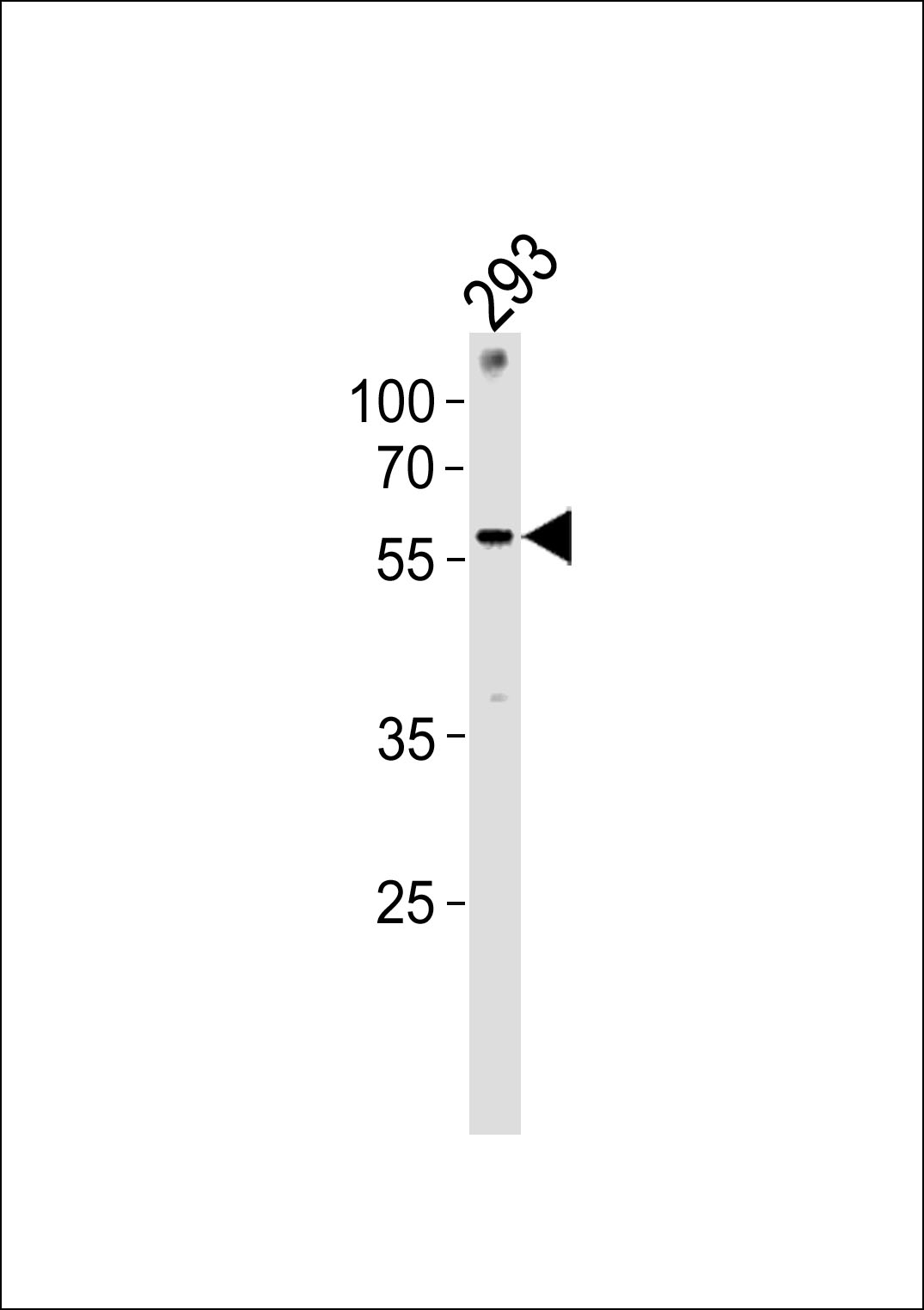 ZNF76 Antibody