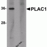 Western blot analysis of PLAC1 in human placenta tissue lysate with PLAC1 antibody at 1 μg/mL in (A) the absence and (B) the presence of blocking peptide.