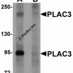 Western blot analysis of PLAC3 in HeLa cell lysate with PLAC3 antibody at 1 μg/mL in (A) the absence and (B) the presence of blocking peptide.