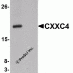 Western blot analysis of CXXC4 in human brain tissue lysate with CXXC4 antibody at 1 μg/mL in (A) the absence and (B) the presence of blocking peptide.