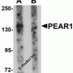 Western blot analysis of PEAR1 in rat kidney tissue lysate with PEAR1 antibody at 1 μg/mL in (A) the absence and (B) the presence of blocking peptide.