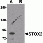 Western blot analysis of STOX2 in human kidney tissue lysate with STOX2 antibody at 1 μg/mL in (A) the absence and (B) the presence of blocking peptide.