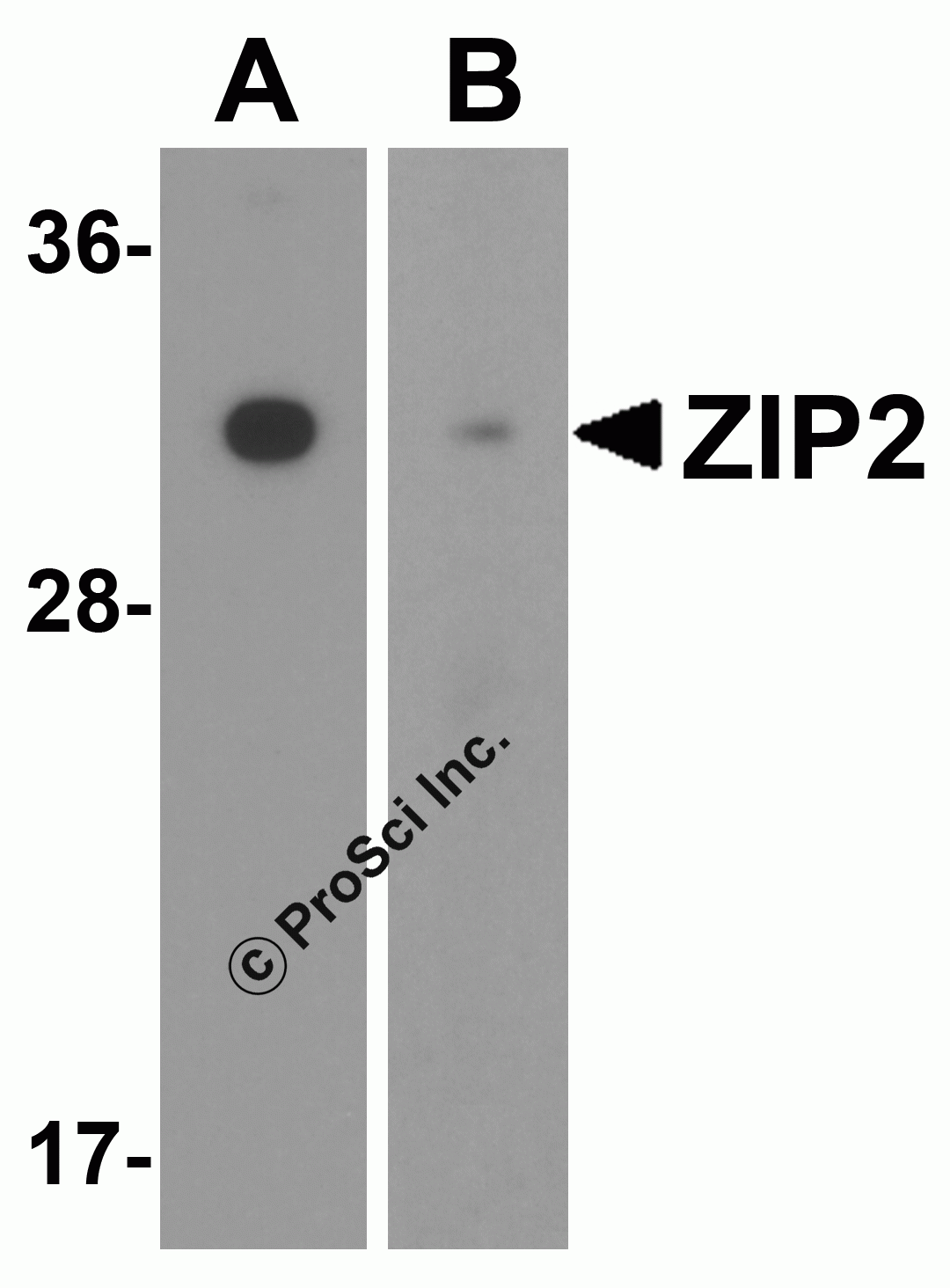 ZIP2 Peptide