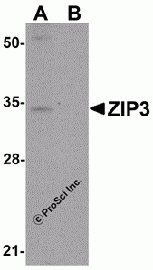 ZIP3 Peptide