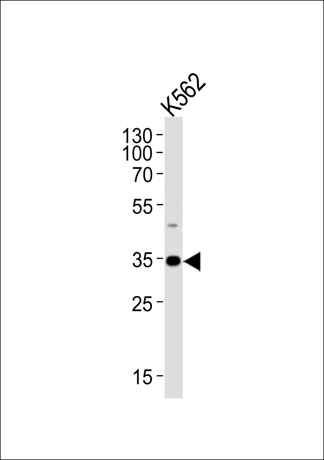 BBS5 Antibody