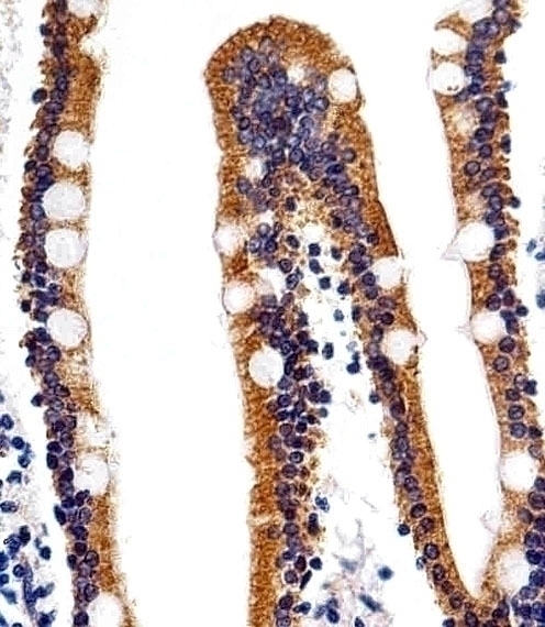 ACVRL1 Antibody