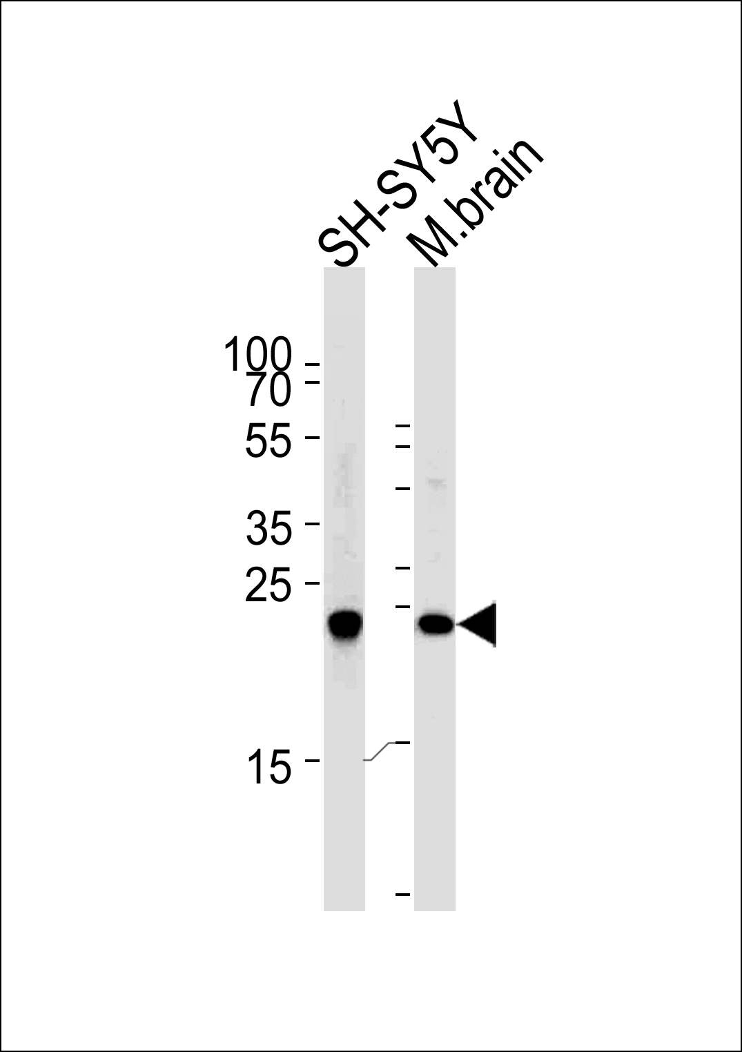 UCHL1 Antibody