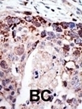 Ataxin3 Antibody
