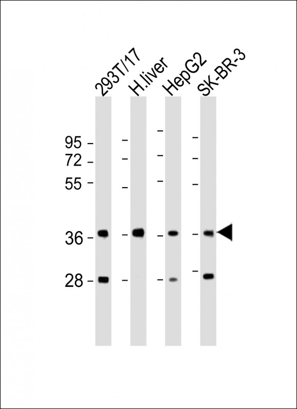 AKR7A3 Antibody