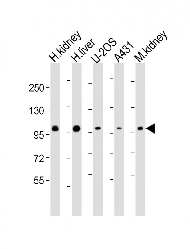ACO1 Antibody