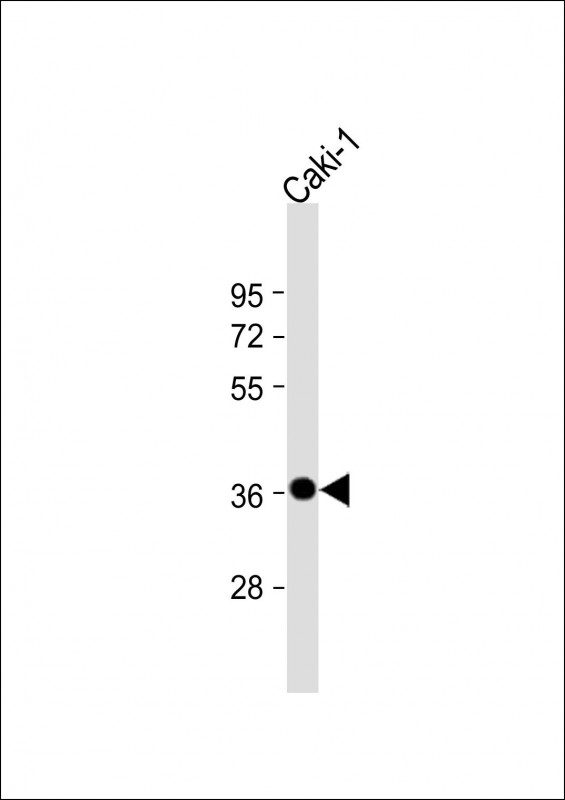 ANKRD1 Antibody