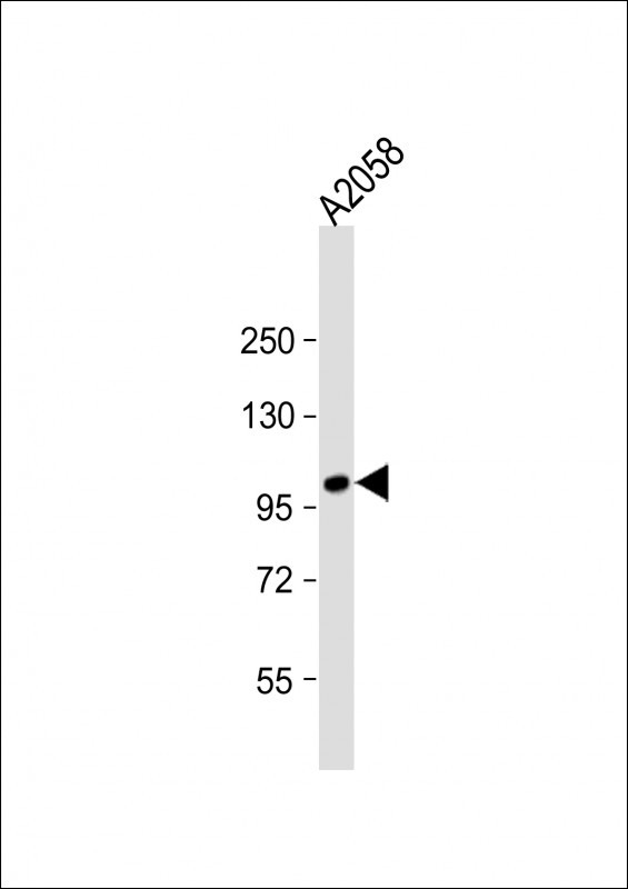 ADAMTS17 Antibody