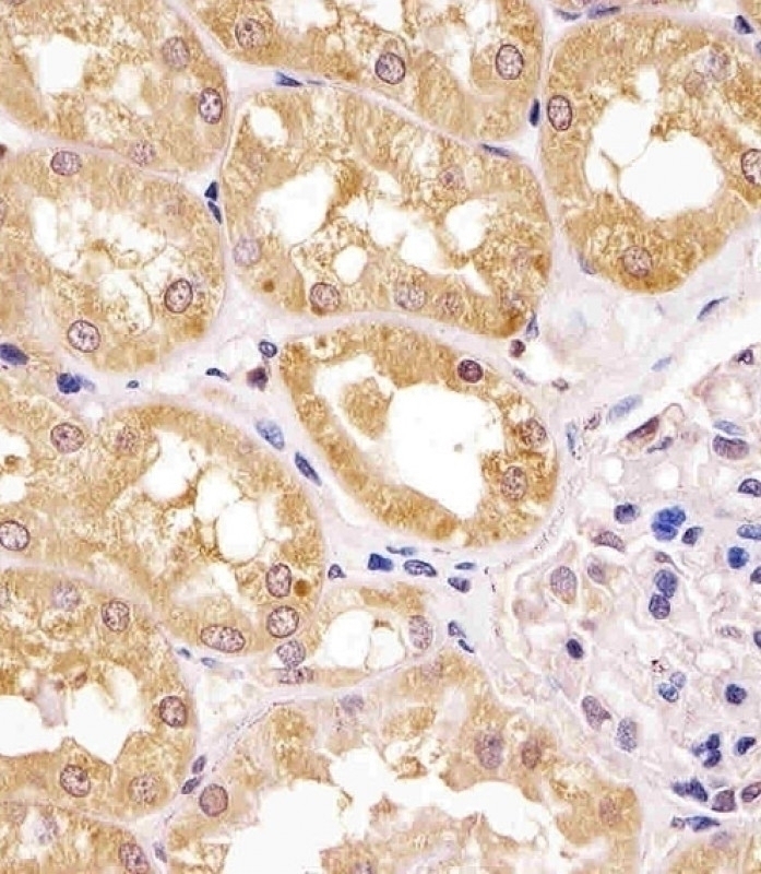 APIP Antibody
